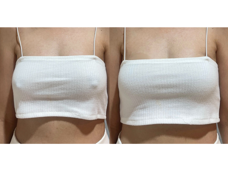 NippyLuv Luxury Nipple Covers (Adhesive)