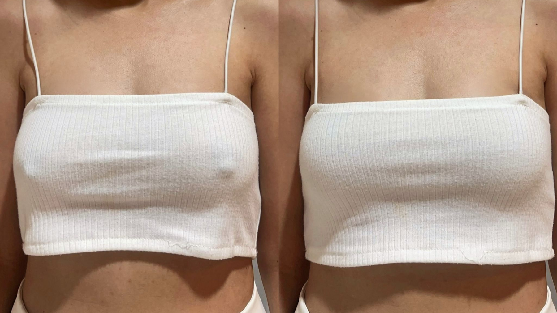 nipple covers before/after